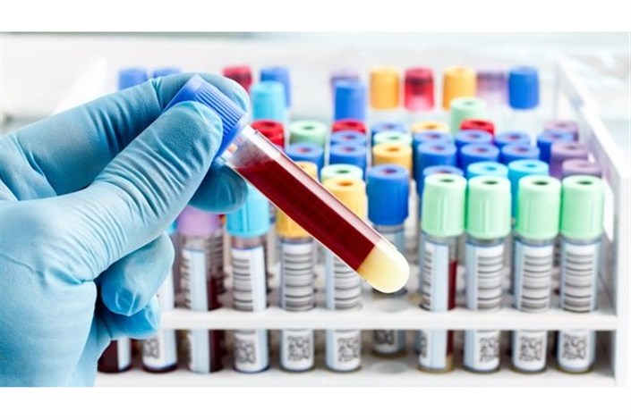 تشخیص انواع مختلف سرطان با یک آزمایش خون