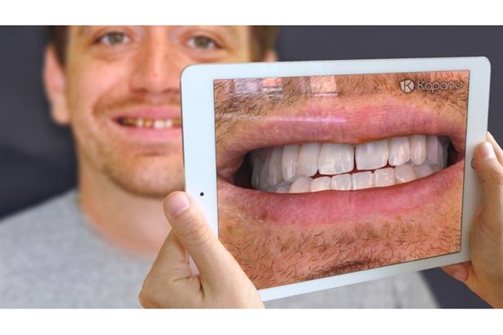 با"آیینه مجازی"مشاهده پیش از جراحی دندان  محقق شد