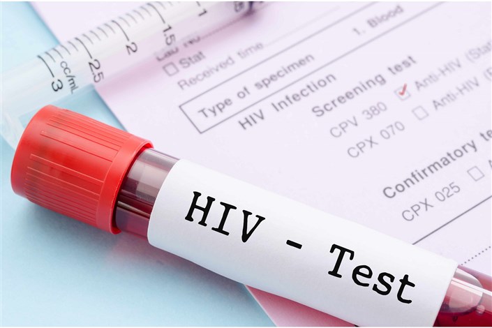 36هزار و 39 تن مبتلا به اچ آی وی در کشور شناسایی و ثبت شده‌اند 