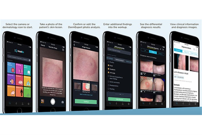 با iOS جدید یک متخصص پوست را به همراه دارید