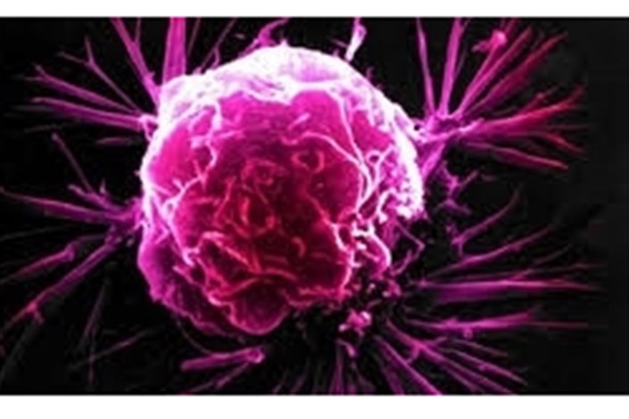 ثبت سرطان در کشور جدی‌تر و علمی‌تر دنبال شود