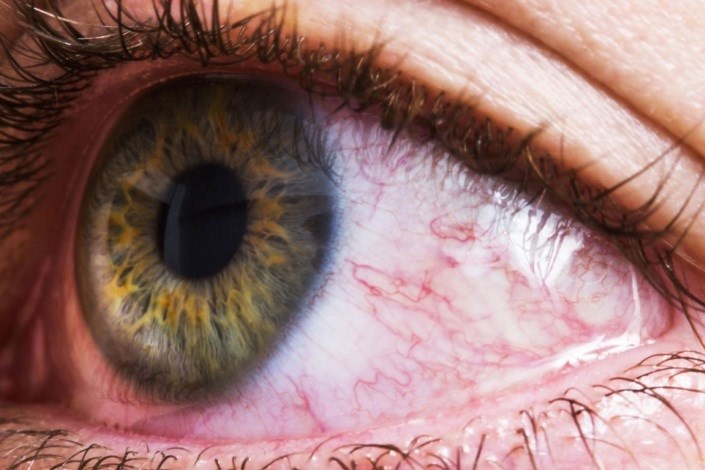 استفاده از تزریق داخل چشمی برای بیماران  دارای دیابت ، فشار خون و چربی خون