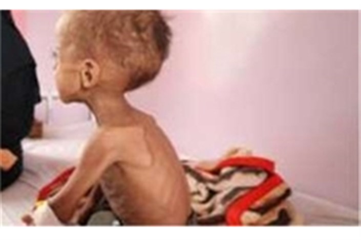 یک میلیون یمنی در معرض ابتلا به وبا