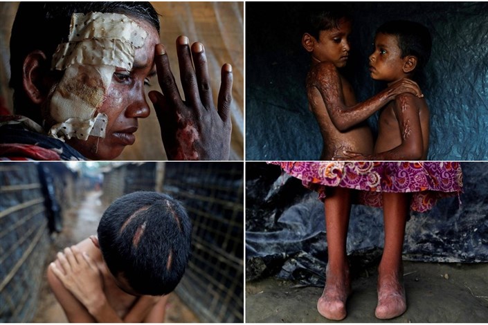 تصاویر دلخراش از شکنجه مسلمانان روهینگیا