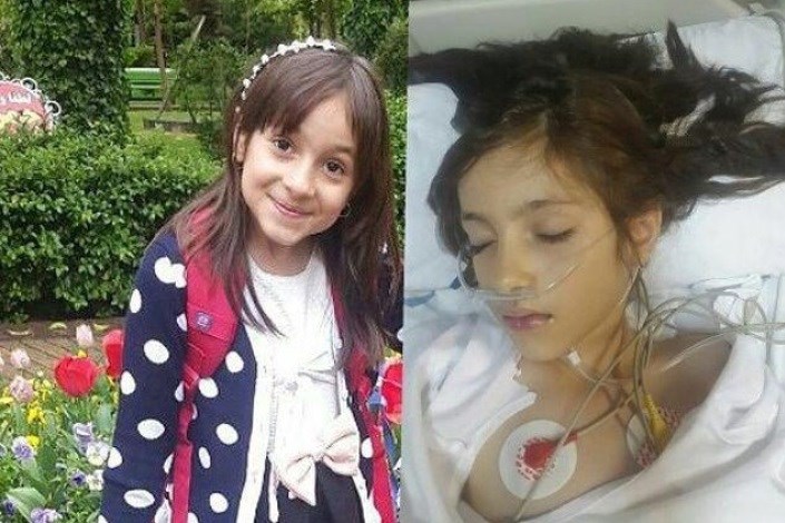 پیگیری پرونده قصور پزشکی یاسمین ۷ ساله  به دستور ویژه وزیر بهداشت 