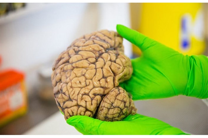 راه اندازی بانک مغز برای مطالعه مغز و بیماری ها/400 نفر برای اهدای مغز ثبت نام کرده اند