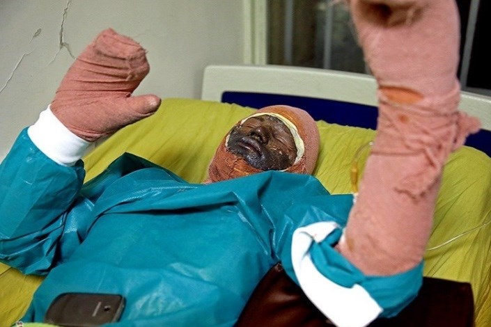  بیمارستان‌ها مکلف اندمصدومان حوادث چهارشنبه سوری  را پذیرش کنند/پیشتازی تهران درمصدومیت  