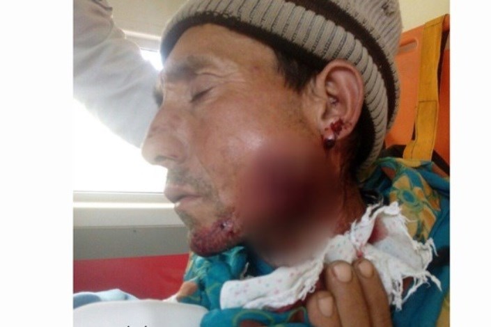 چوپان  در درگیری با پلنگ زخمی شد /دامپروری سنتی  در زیستگاه پلنگ، حادثه آفرید+عکس 