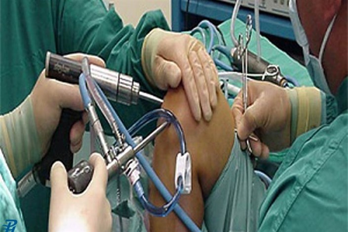 انجام سالیانه  30 هزار جراحی تعویض مفصل زانو در کشور