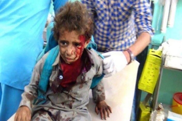 بمب آمریکایی قاتل کودکان یمنی 