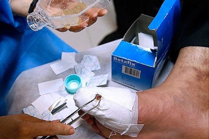 لارو درمانی روشی نوین در درمان  زخم های دیابتی  است