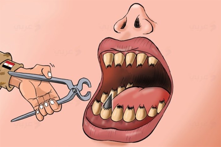 کشیدن دندان تیز انتقاد
