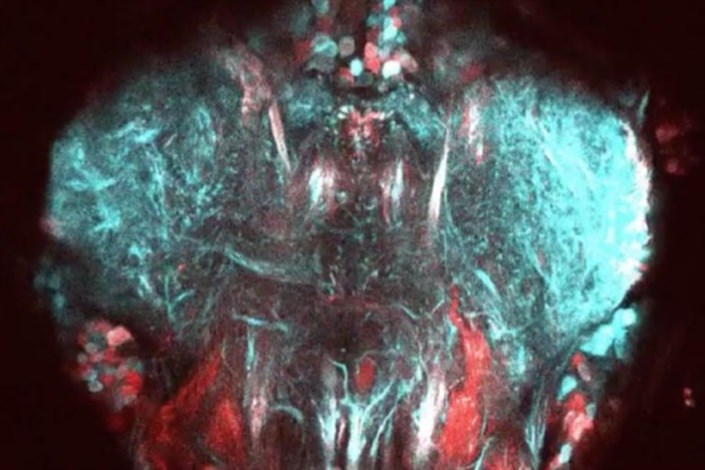 ارائه تصویربرداری جدید برای مشاهده حرکت نورون های مگس