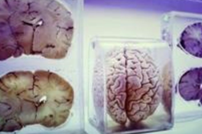 موزه‌ای متفاوت برای اکتشاف درباره مغز