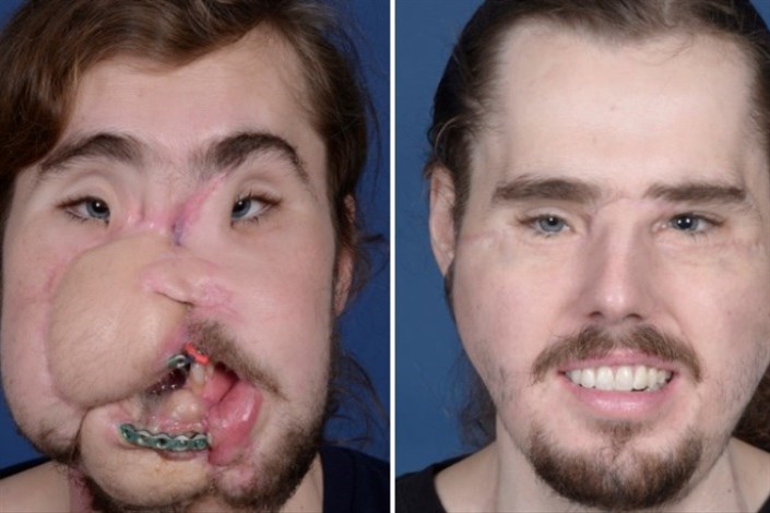 کمک علم به بازیابی چهره مرد 26 ساله 