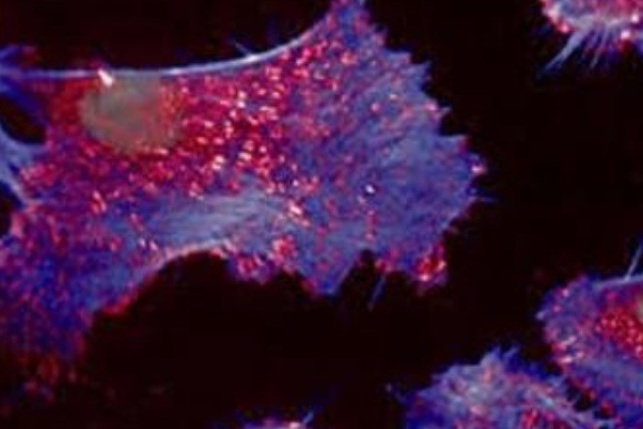   سلول های سرطانی می توانند راه خود را از میان بافت‌های بدن با هول دادن پیدا کنند