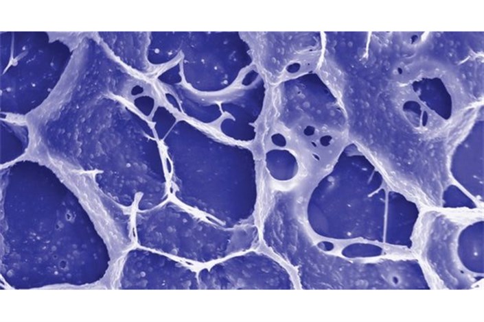 تولید اسپری نانو-ژل برای جلوگیری از رشد تومورها