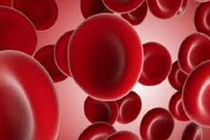   یک درمان ترکیبی جدید و بالقوه برای مبارزه با یک بیماری خونی نادر