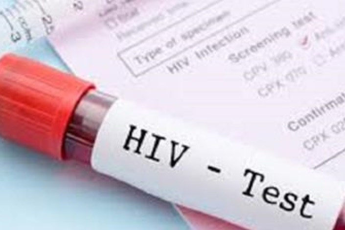 گیرنده معیوب ایمنی  دلیلی برای مشکلات HIV 