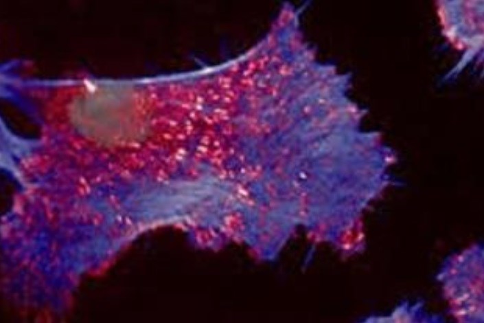 سلول های بنیادی می توانند آسیب بافتی ناشی از پرتو درمانی را مهار کنند