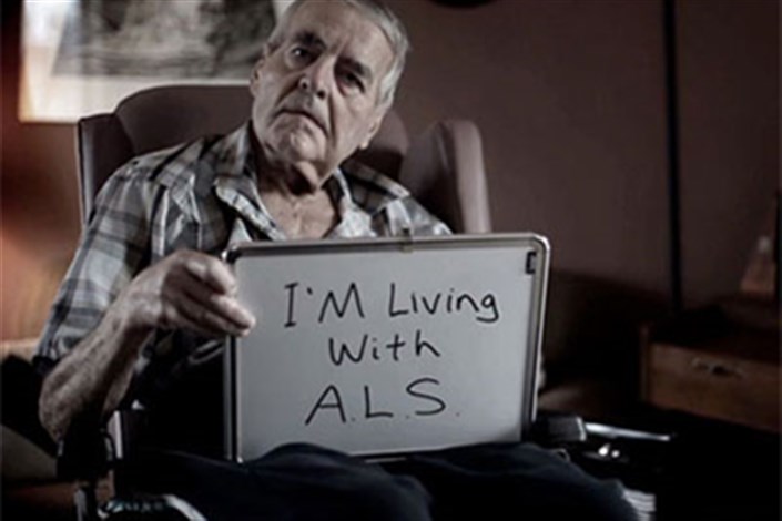  عوامل موثر بر بیماری ALS/ بیماری‌های شایع مغز و اعصاب