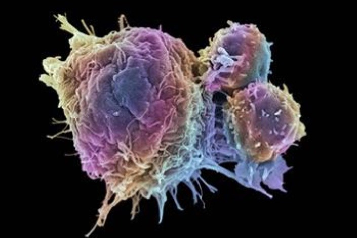 رشد سرطان از یک سلول