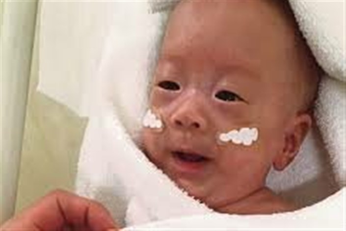 نوزاد 268 گرمی  ژاپنی زنده ماند و در سلامت کامل از بیمارستان مرخص شد+عکس 