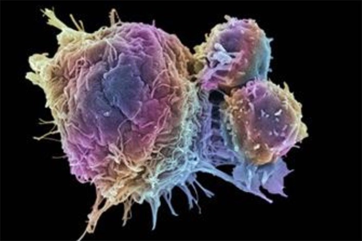 رشد سرطان در بدن می تواند از یک سلول منشا بگیرد