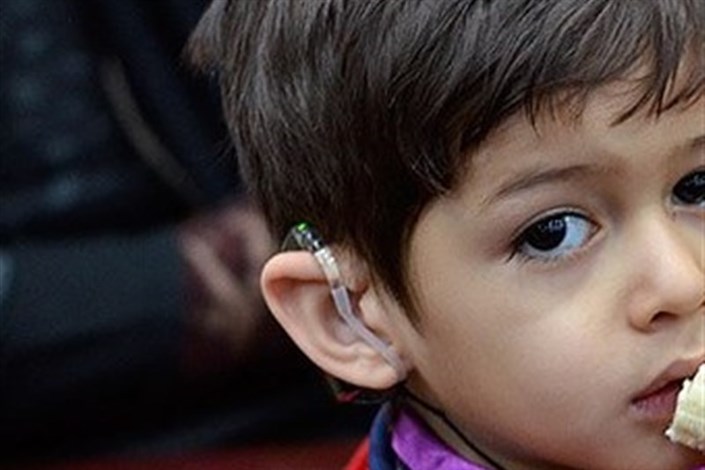 تامین قطعات مورد نیاز کودکان کاشت حلزون شنوایی بصورت غیرحضوری