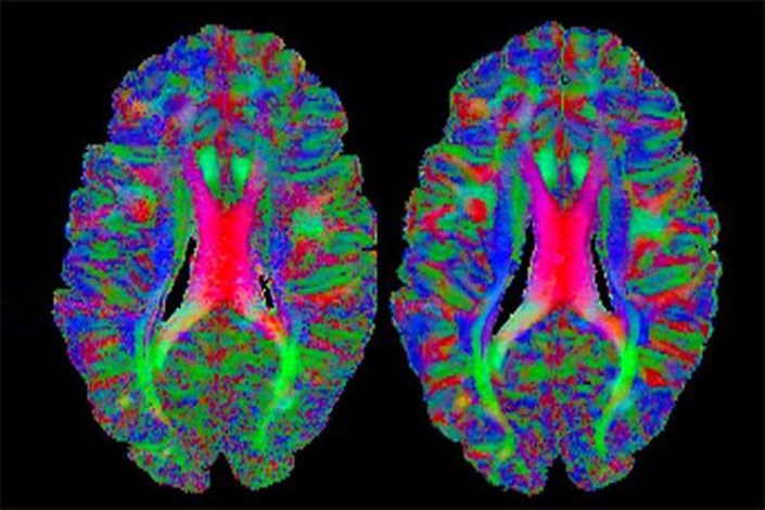 ارائه 19 خدمت جدید به پژوهشگران نقشه‌برداری مغز