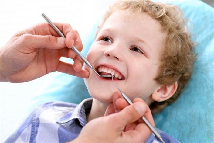 وجود حداقل 5 دندان پوسیده در دهان کودکان  زیر 12 ساله ایرانی