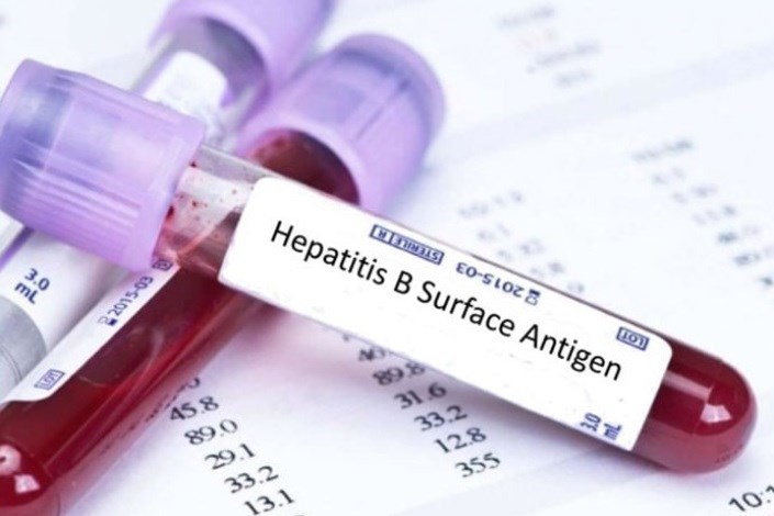 درمان کامل هپاتیت C با داروهای تولید کشور