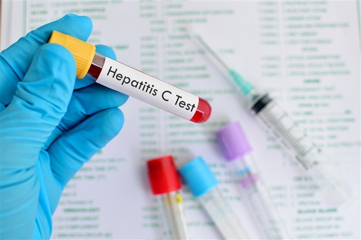درمان کامل هپاتیت c با ۳ میلیون تومان/۴۰ درصد افراد بالای ۴۰ سال کشور کبد چرب دارند
