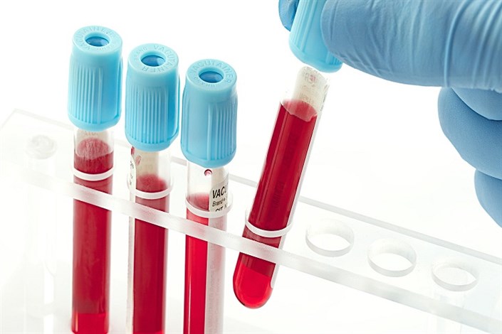 رصد کارایی سلول های بنیادی پیوندی با تست خون