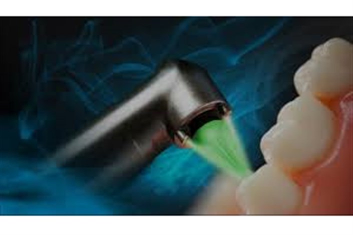  کاربردهای لیزر در درمان‌های دندان‌پزشکی