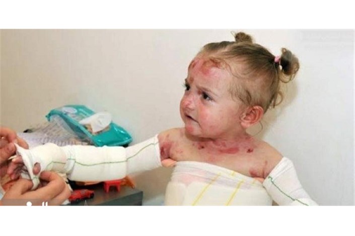  مقصر عدم تامین به موقع پانسمان بیماران پروانه‌ای کیست؟/ شایعه مرگ ۱۵ کودک مبتلا به بیماری EB 