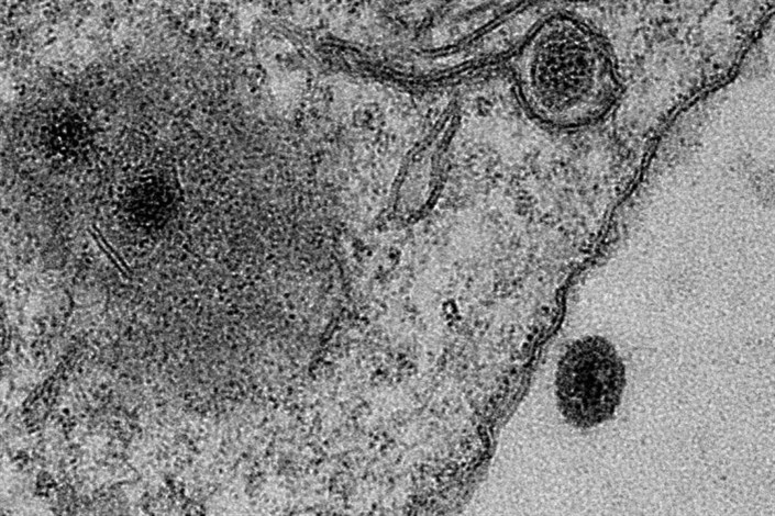 ژنوم ۹۵درصد از ویروس‌های فاضلاب، تطابقی با ویروس‌های شناخته‌شده ندارد