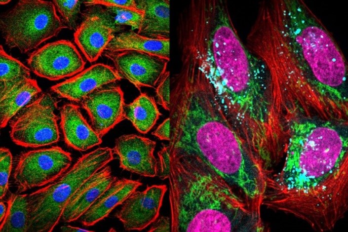 ارتقای تصویربرداری سلولی با استفاده از نانو مواد