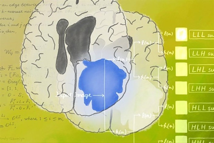 طبقه‌بندی تومور مغزی با استفاده از یادگیری ماشین
